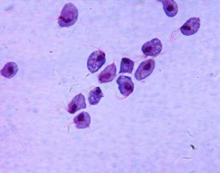 Cả nam và nữ đều có thể nhiễm nấm candida Cả nam và nữ đều có thể nhiễm nấm candida